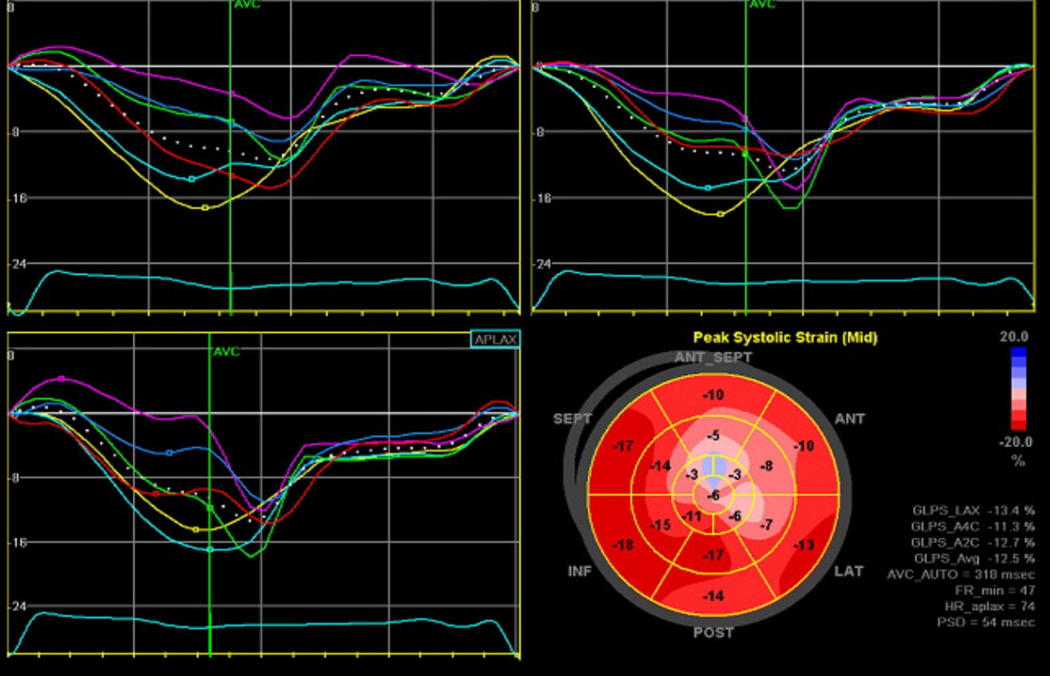 different heart scans to help you understand your results