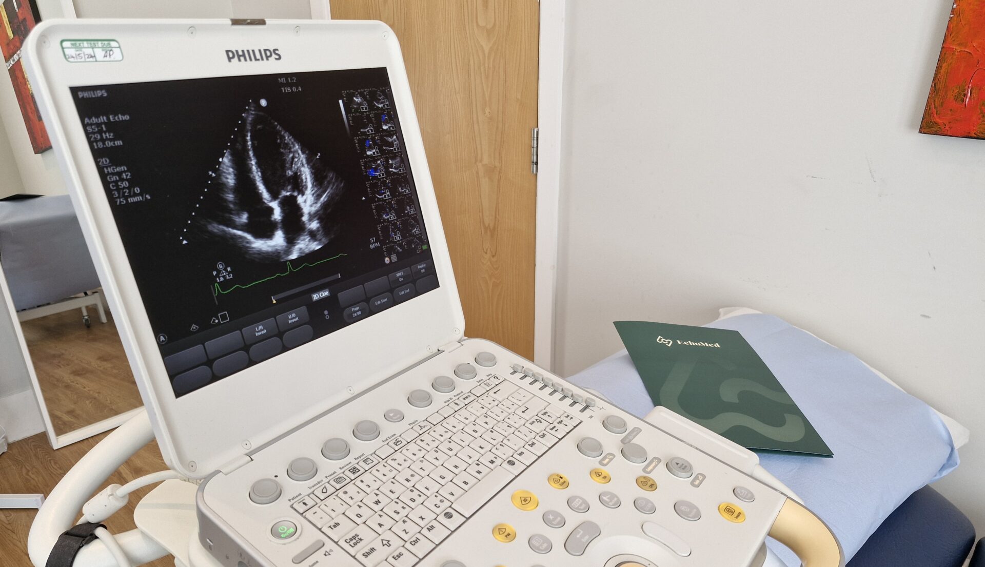 Image of an echocardiogram displayed on a machine at the Echomed clinic